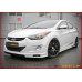 sequence quantum edition kit hyundai elantra 2010-13